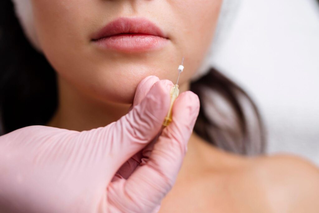 Thread Lifts for Face in Pompano Beach, FL