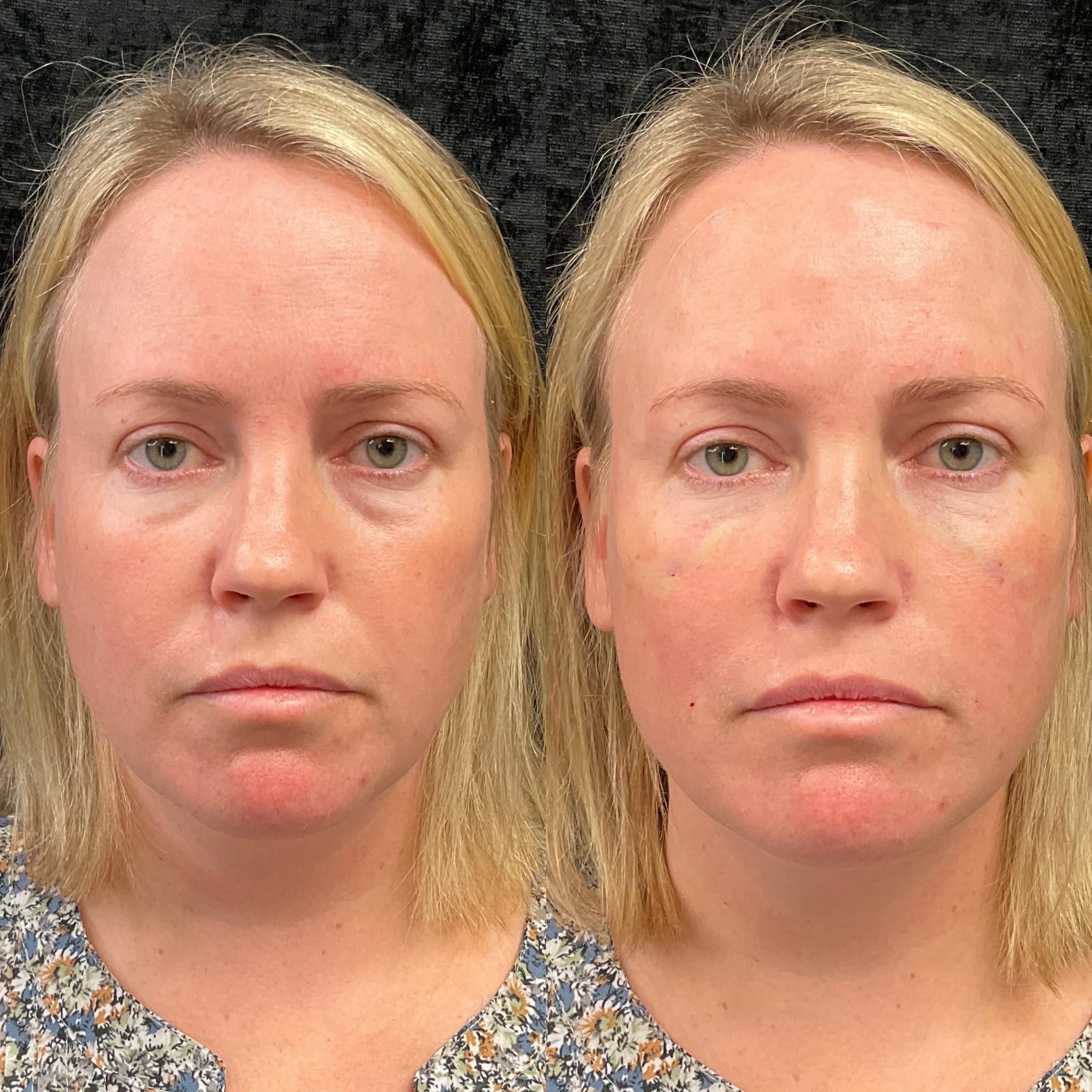 Expert Care by Chad Van Horn, PA-C