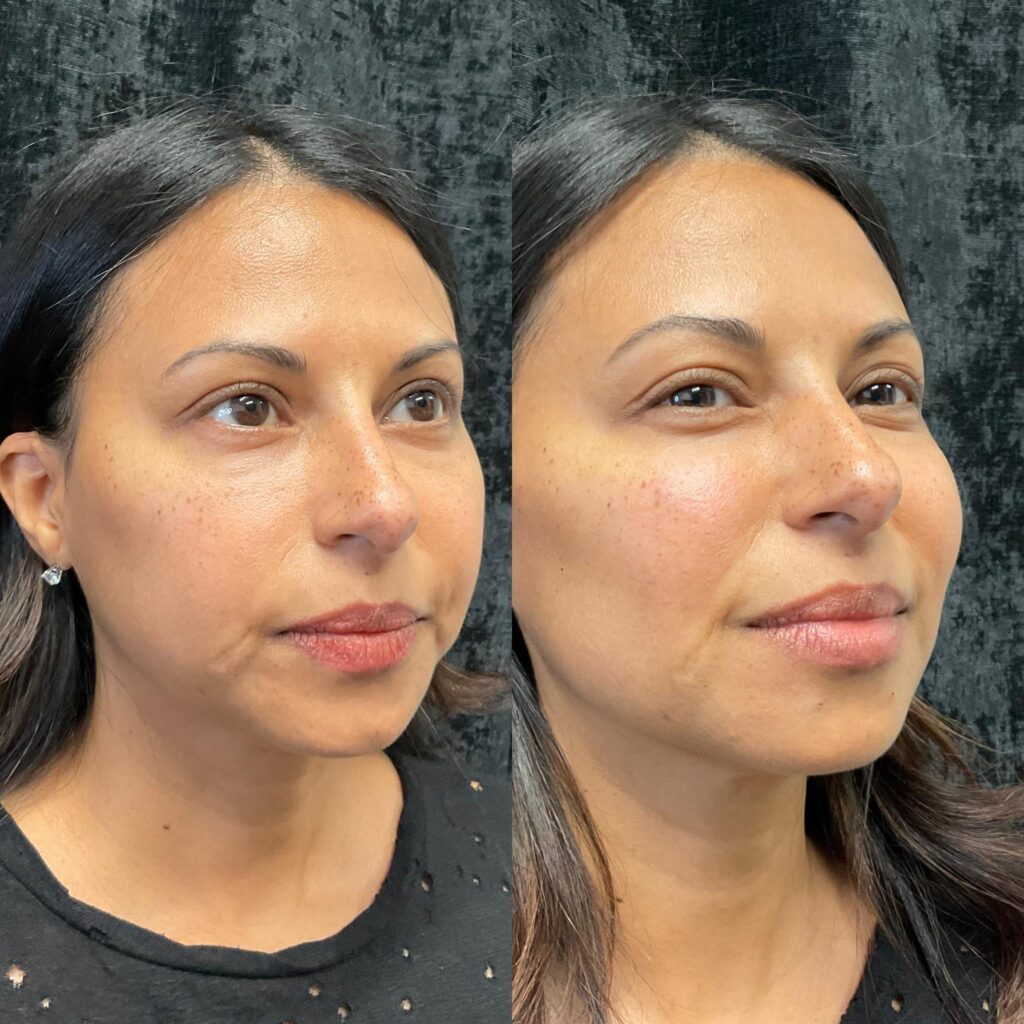 Our Approach: Personalized Facial Balancing Plans at Icon