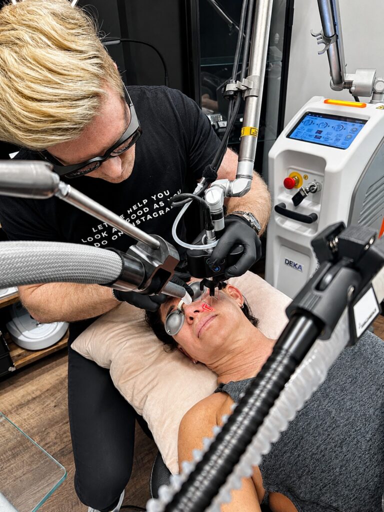 Why Choose Icon Aesthetics & Wellness for Acne Scar Treatment in Pompano Beach? 